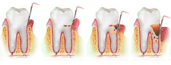 Anziani e igiene orale: arriva il dental coach
